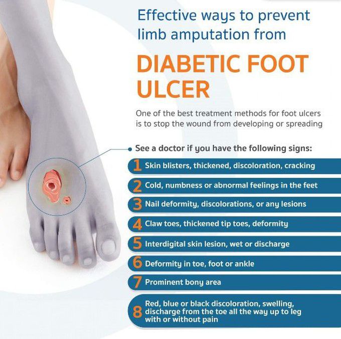 Treatment for Diabetic Foot - MEDizzy