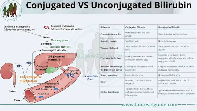 Conjugated Vs Unconjugated Bilirubin