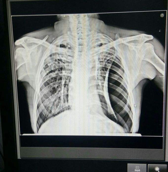 Radiology