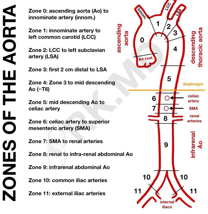 Zones of Aorta