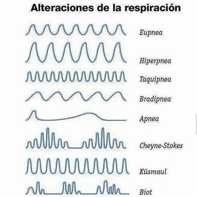 Alteraciones de la respiración