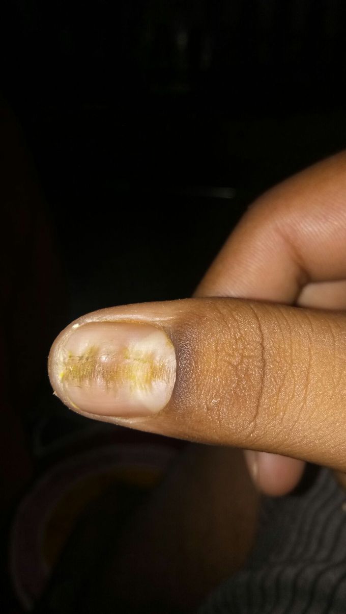Diagnosis please