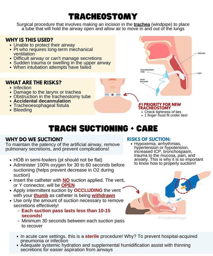 Tracheostomy I