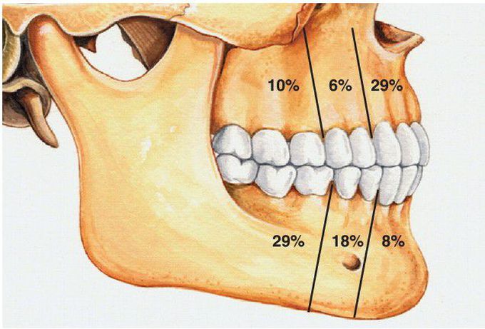 Odontogenic Fibroma