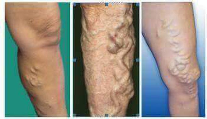 What these lesions are?