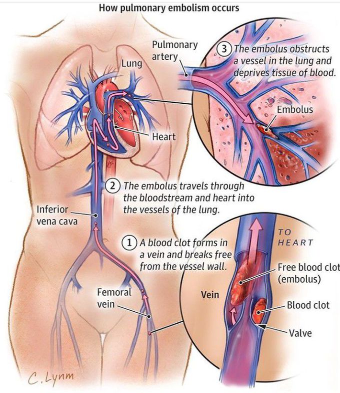 Heart