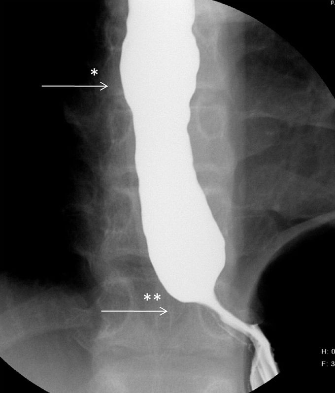What's your diagnosis??