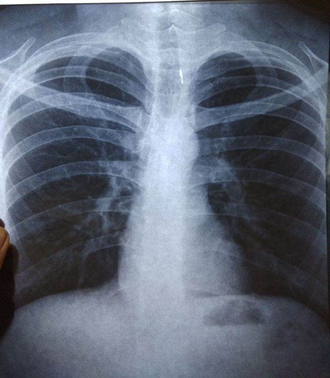 Diagnosis