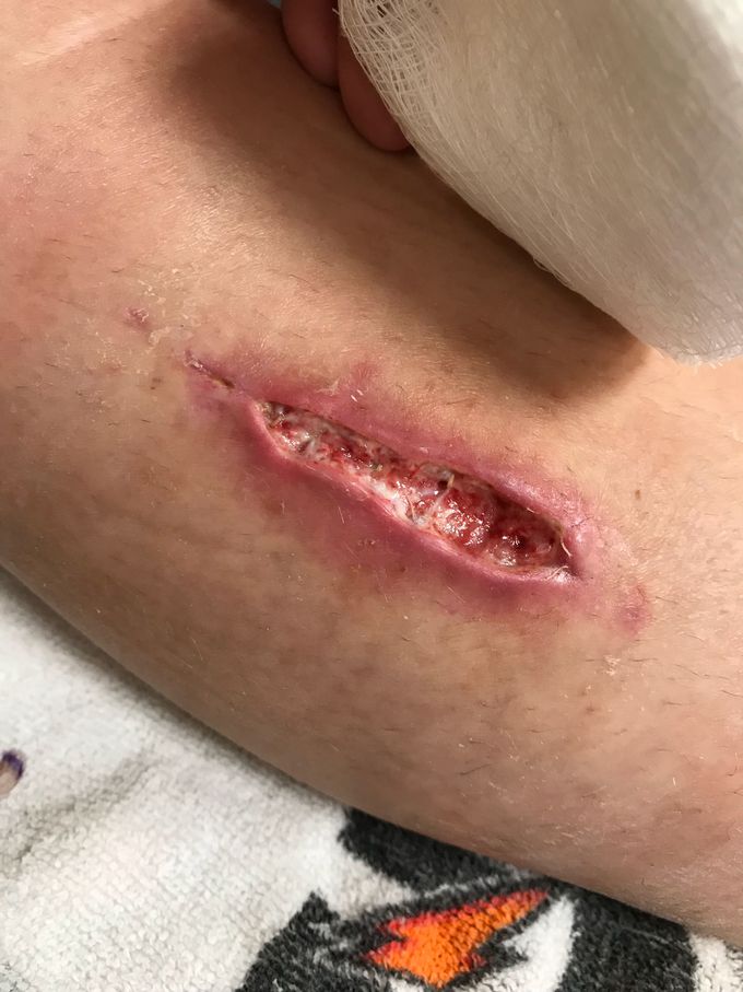 Update from Last Pic