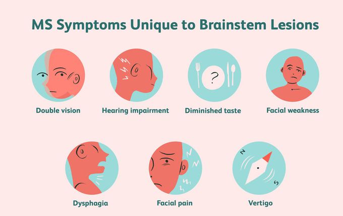 Symptoms of brain lesion