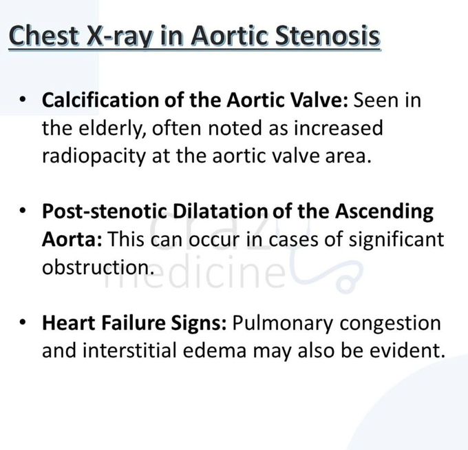 Aortic Stenosis IX