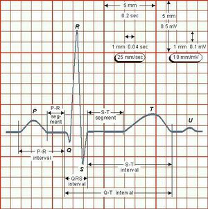 ECG wave - MEDizzy