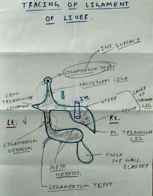 Tracing of ligament of liver - MEDizzy