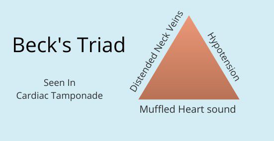Beck's Triad for Cardiac Tamponade