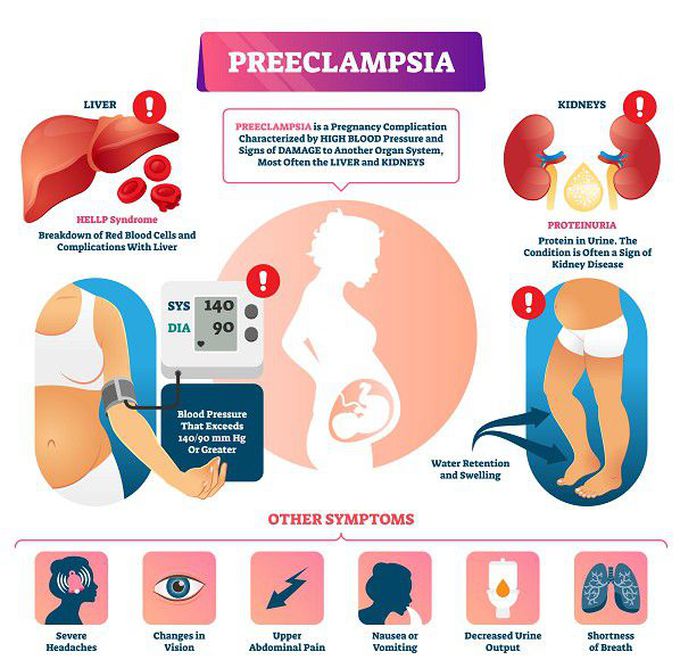 Preeclampsia