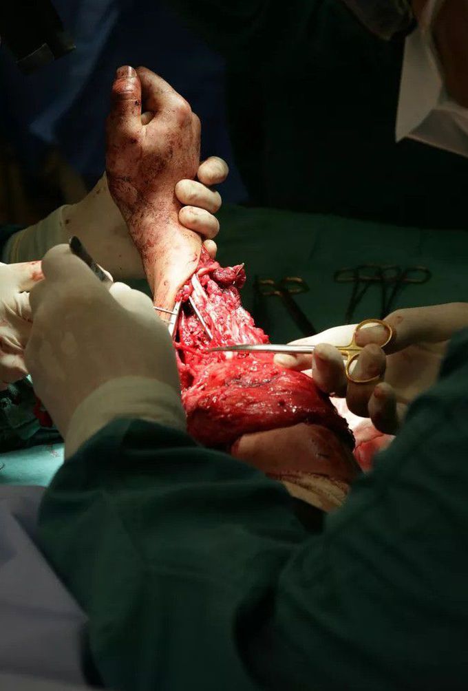 orthopedic surgery