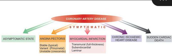 Coronary artery disease