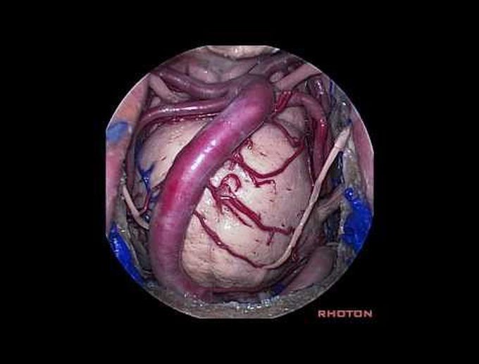 The Nose for Neurosurgeons