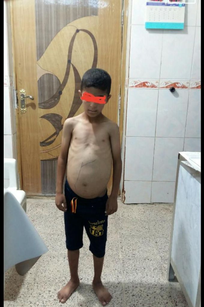 What is your diagnosis