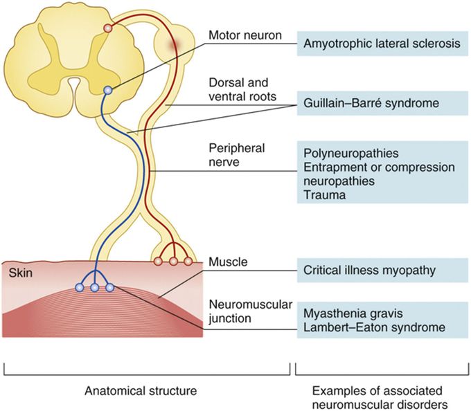 Neuromuscular disorders