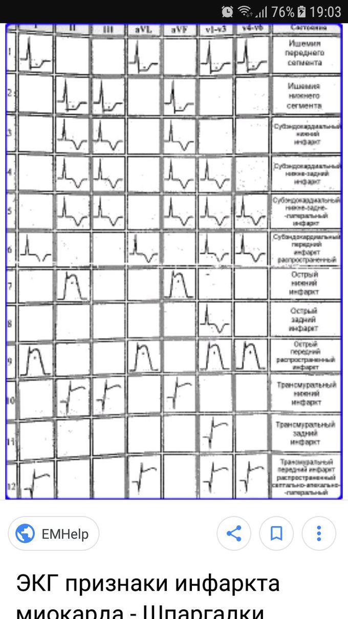EKG EKG EKG