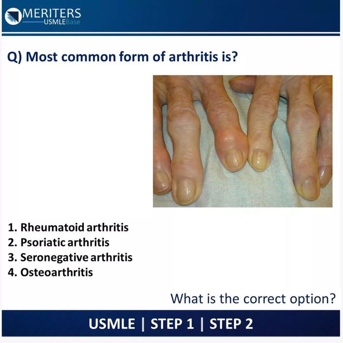 Most common form of arthritis