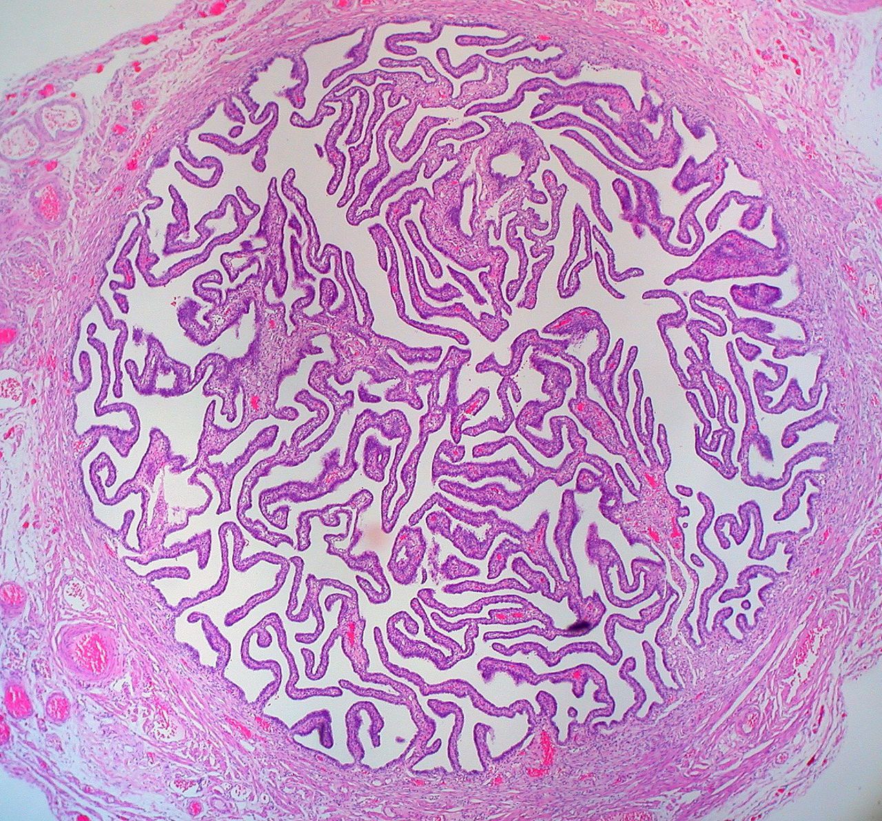Histology of FALLOPIAN TUBE - MEDizzy, image size:1280x1192