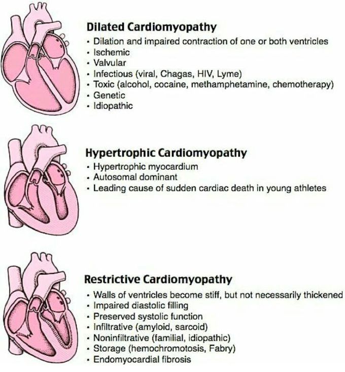 Types of cardiomyopathies...