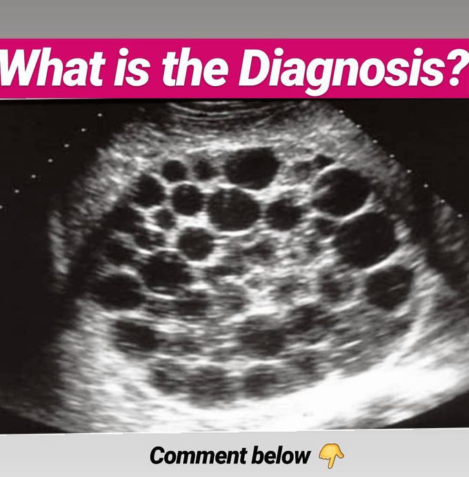 Abdominal scan