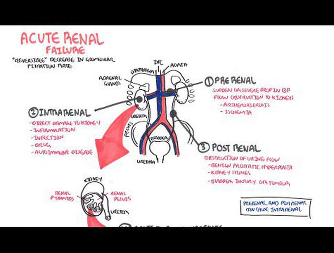 Kidney Diseases I-
Acute Renal Failure