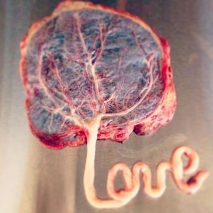 Human placenta with love