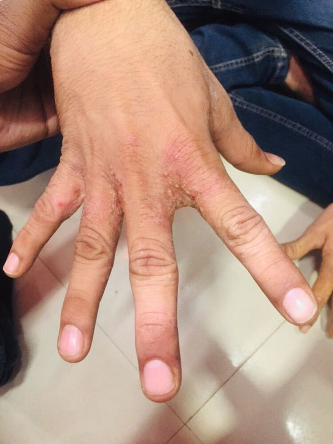 What is your diagnosis???
