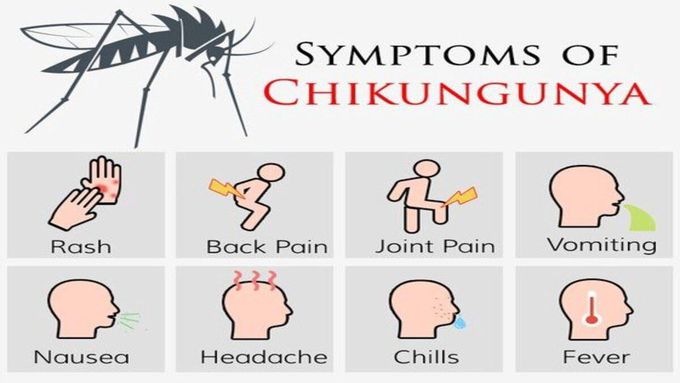Symptoms of Chikungunya