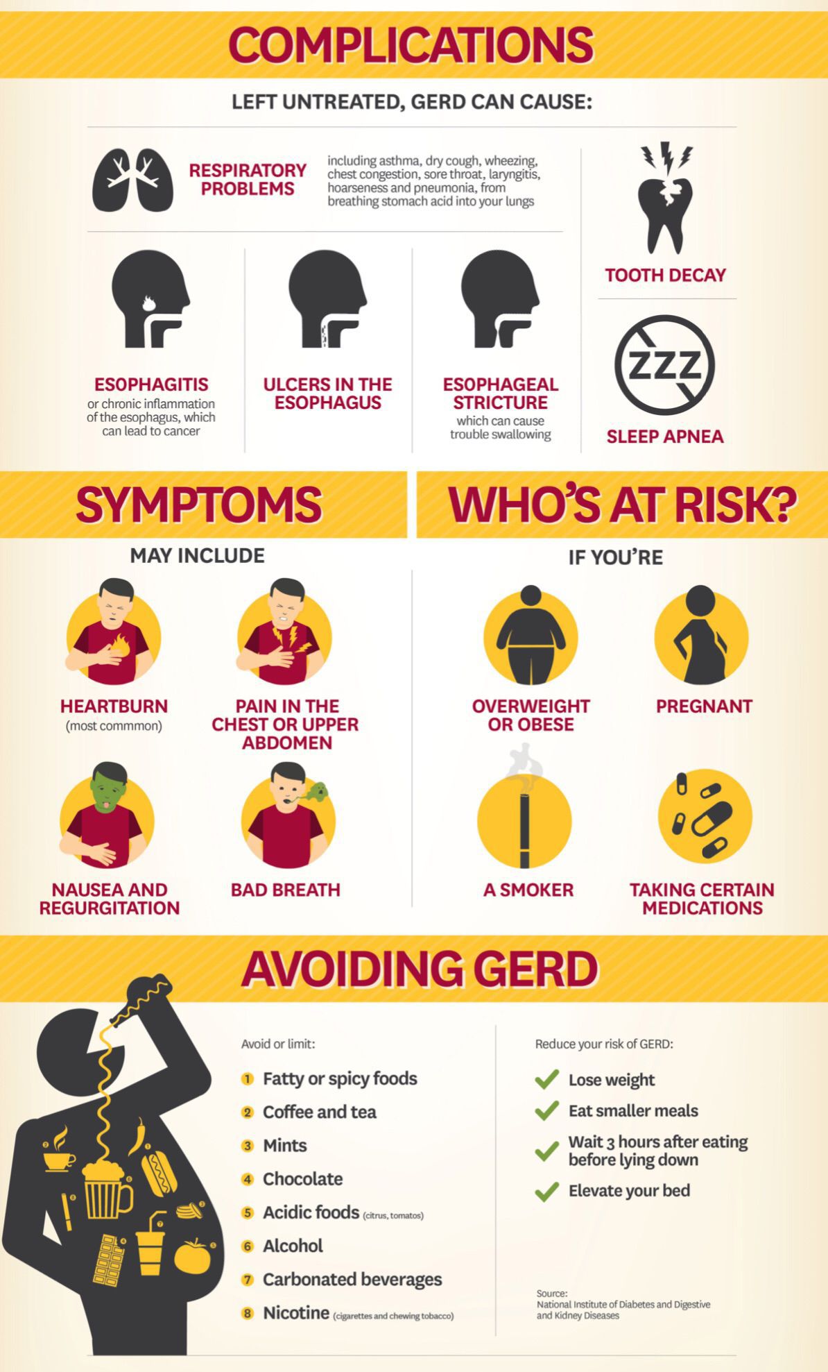 Gasteroesophageal reflux disease (GERD) - MEDizzy