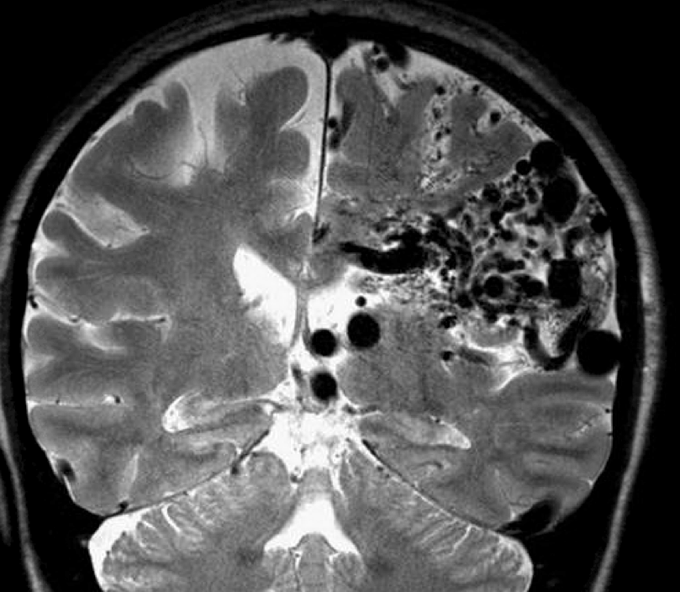 What's your diagnosis?