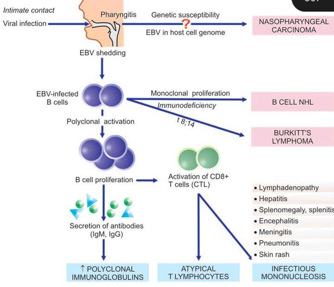 Epstein barr virus pathogenesis