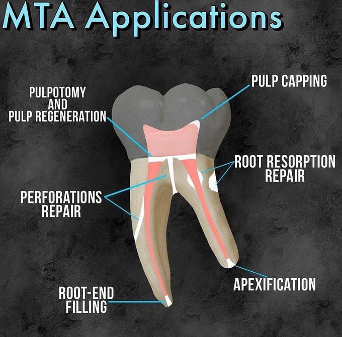 Applications of MTA