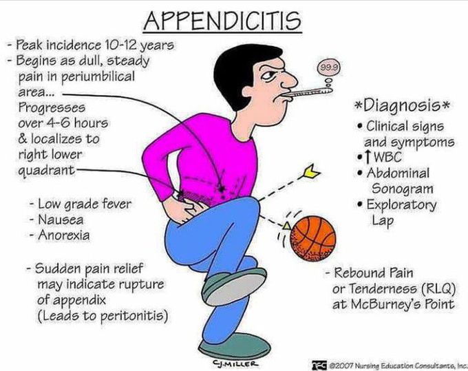 Appendicitis
