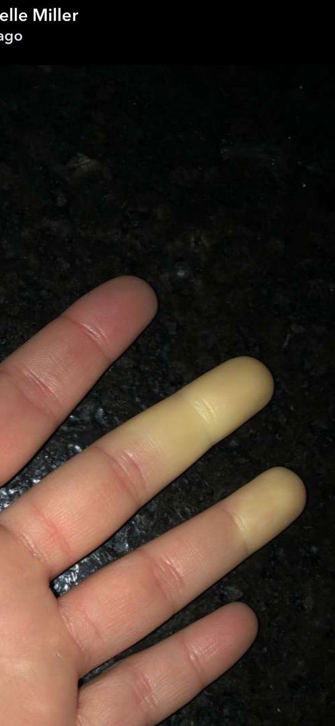 Diagnosis?