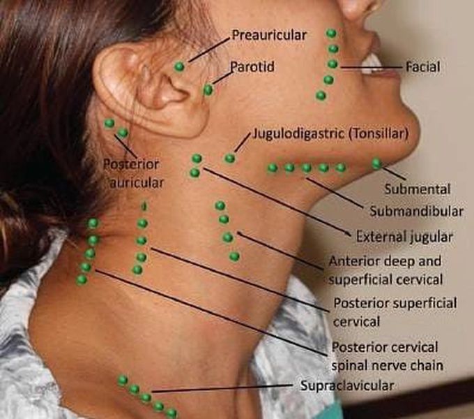 Palpable Lymph Nodes of the head and neck