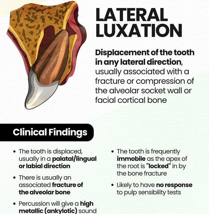 Lateral Luxation