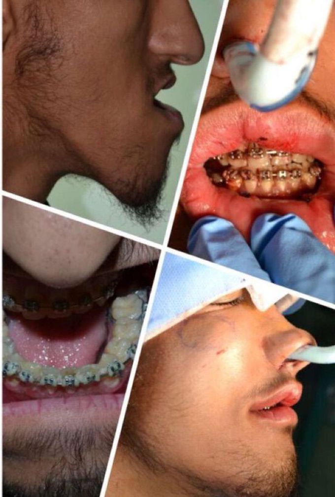 What is the name of this condition ??