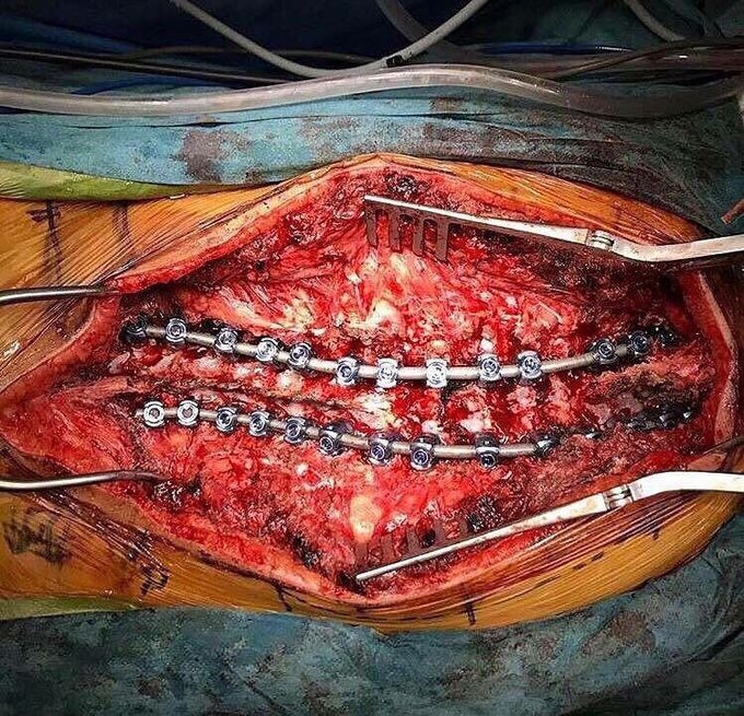 Neurocirugia