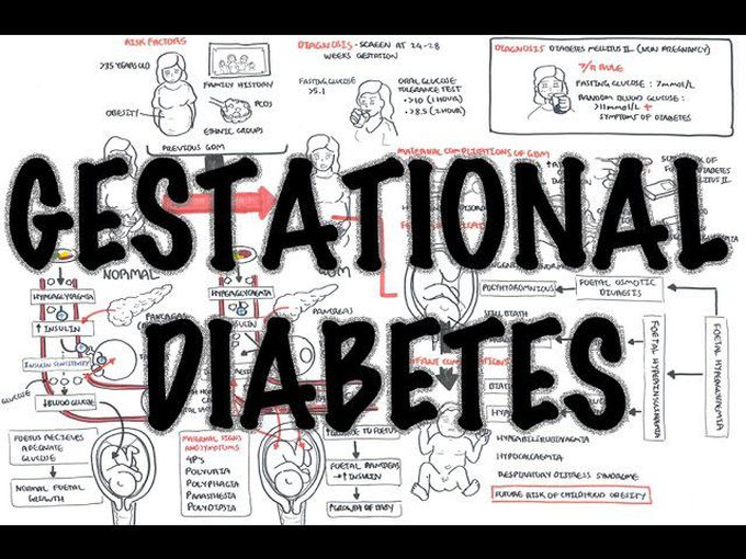 Gestational Diabetes