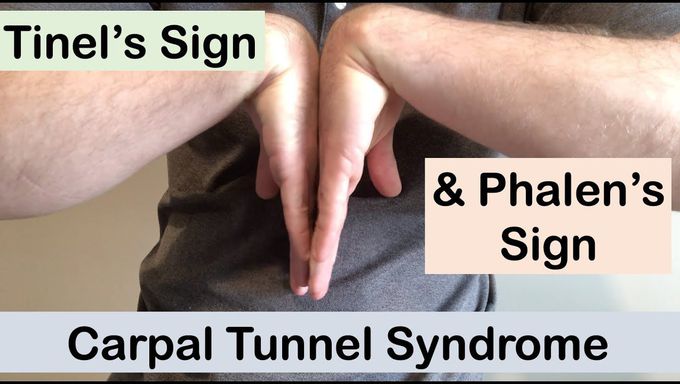 Carpal tunnel syndrome | Tinel’s sign and Phalen’s sign | Clinical Examination
