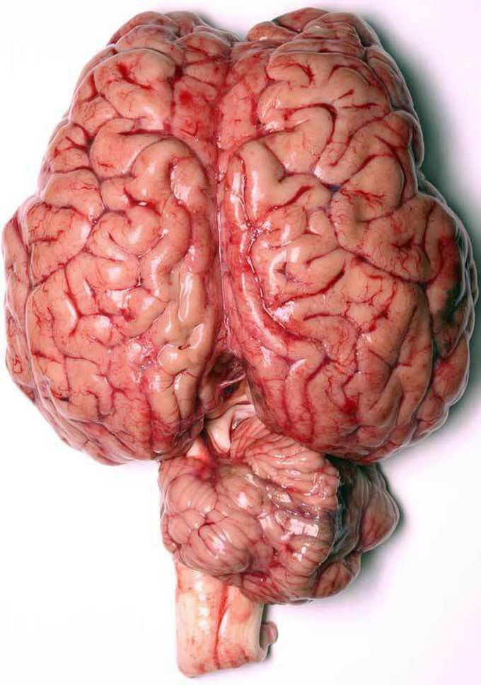 Human brain system