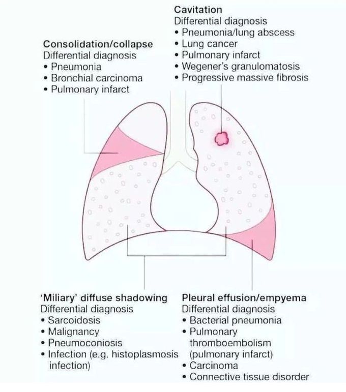 Pathologies of the Lungs