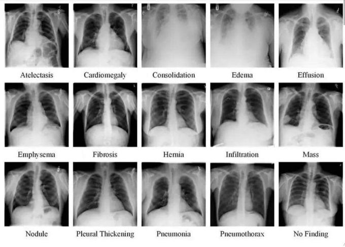 #Radiology 🫁✔️