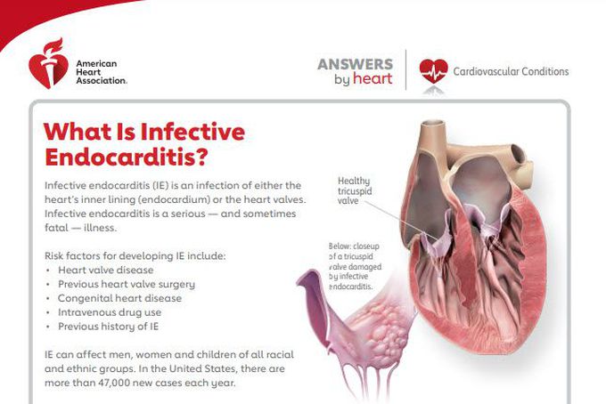 Endocarditis