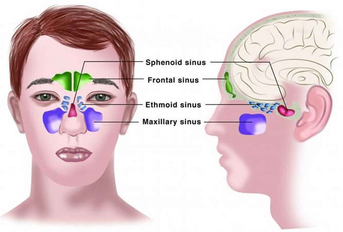 Catarrh